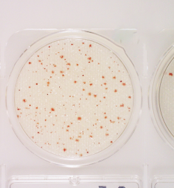 Đĩa Compact Dry Kiểm Tra Tổng Khuẩn Hiếu Khí Total Viable Count – Tc